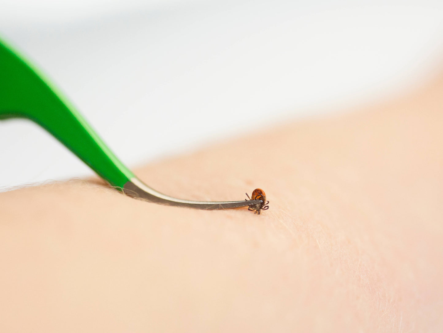 🪲 TickCheck Premium Tick Remover Kit | Compact Tick Removal Solution 🐾