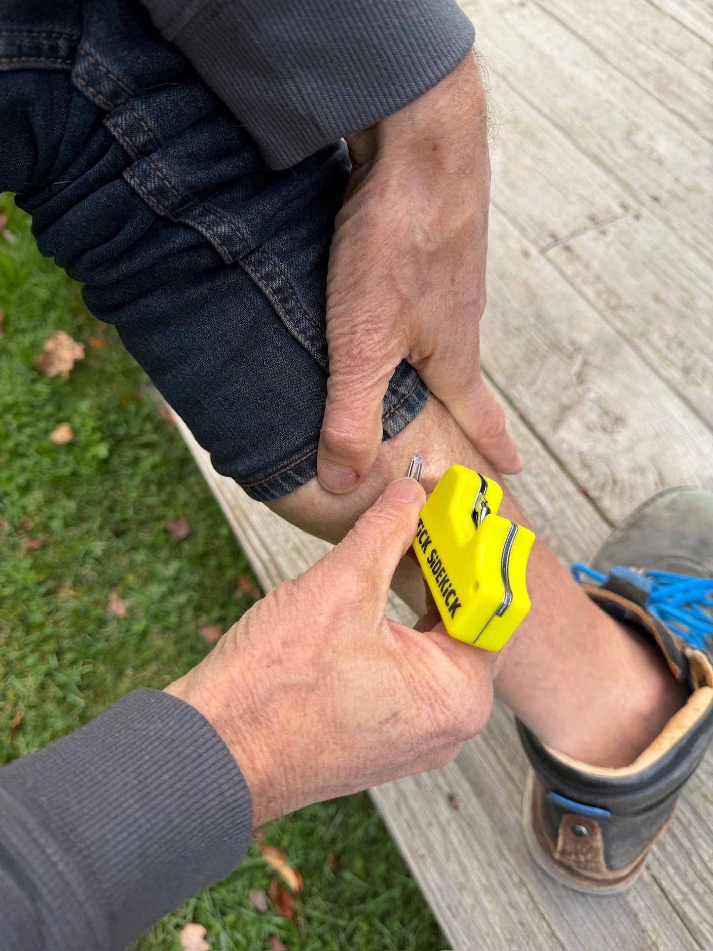 🔦🪲 TiCK SiDEKiCK | Compact Multi-Tool Tick Remover for Pets & People 🐾